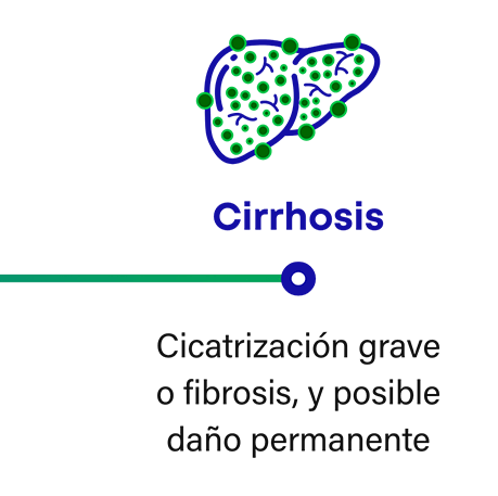 Cómo progresa la NASH: la cirrosis es una fibrosis o cicatrización grave que puede provocar un posible daño permanente