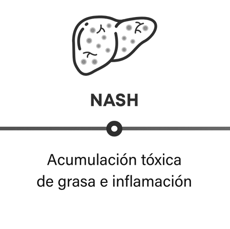Cómo progresa la NASH: la NASH puede causar acumulación tóxica e inflamación