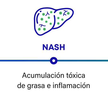 Cómo progresa la NASH: la NASH puede causar acumulación tóxica e inflamación