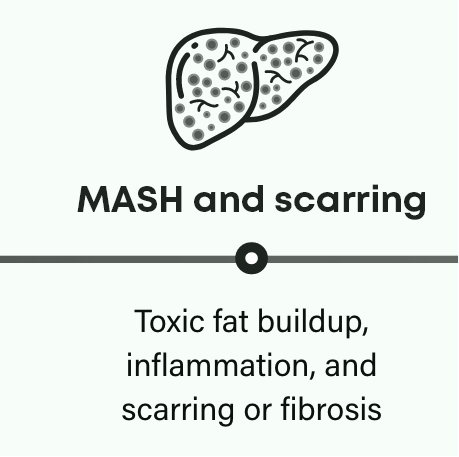 MASH is progressive: MASH and scarring frame