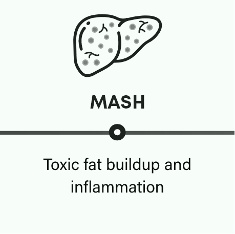 MASH is progressive: MASH and liver frame
