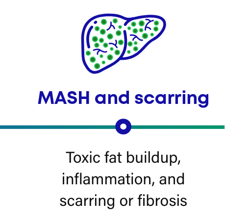 MASH is progressive: MASH and scarring frame