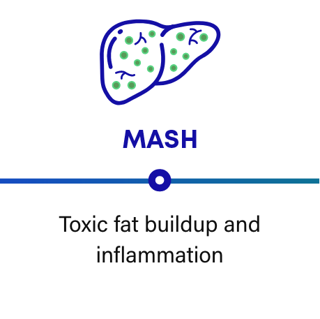 MASH is progressive: MASH and liver frame