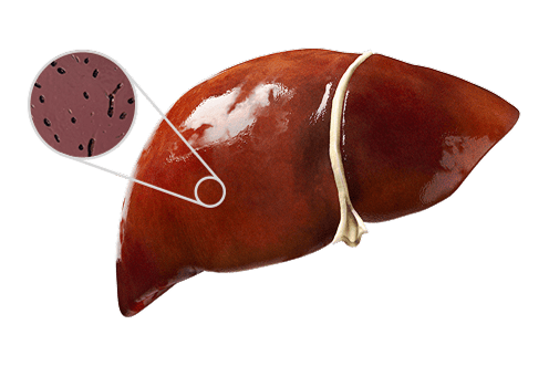 Healthy liver zoom in image