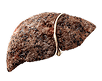 Liver with cirrhosis image